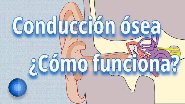 ¿Cómo funcionan los audífonos de conducción ósea?